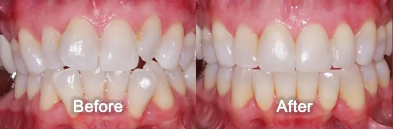 Before / After