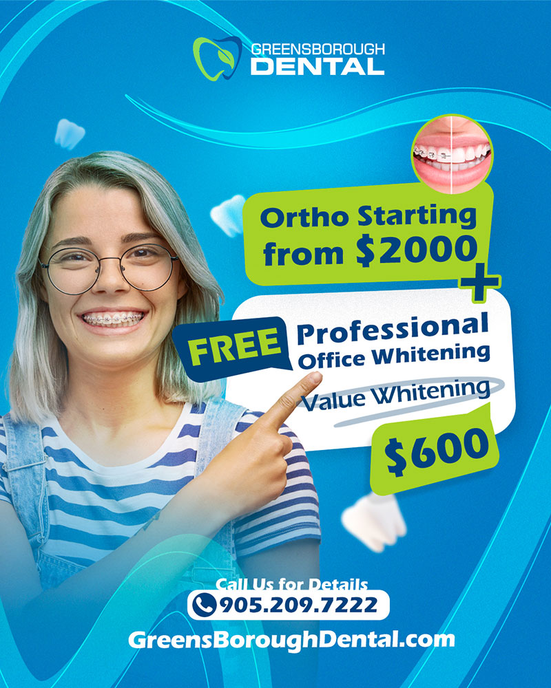 Professional Whitening Offer