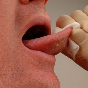 oral cancer screening - Man holding swab on tongue