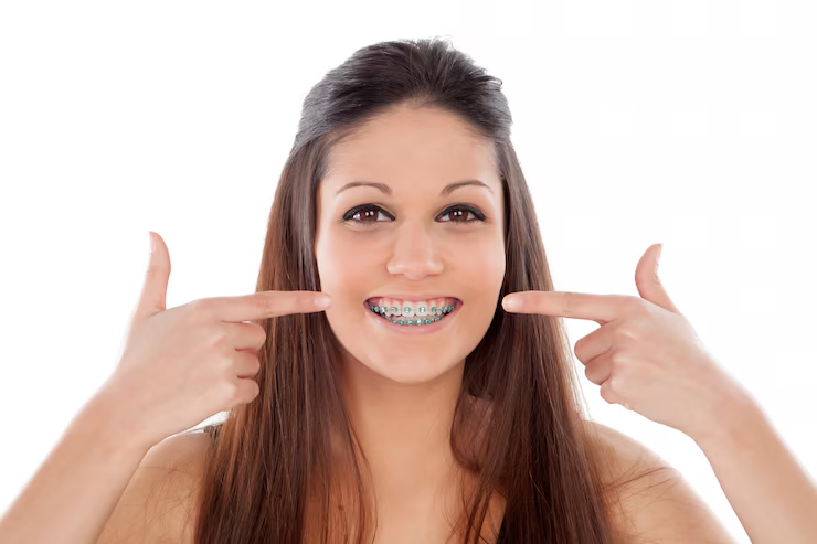 Dental Braces Maintenance: Care Tips & Tricks